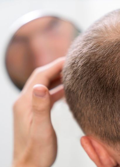 Can moderate hair fall still be treated? 